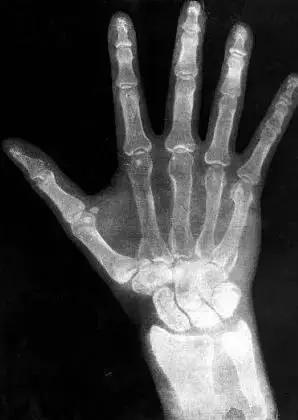 世界科學(xué)史十大“最意外發(fā)明”(圖3) 世界科學(xué)史十大“最意外發(fā)明”(圖3)