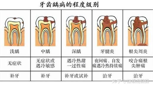 我在長(zhǎng)沙市口腔醫(yī)院補(bǔ)牙全過(guò)程及經(jīng)驗(yàn)分享(圖6) 我在長(zhǎng)沙市口腔醫(yī)院補(bǔ)牙全過(guò)程及經(jīng)驗(yàn)分享(圖6)